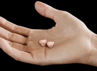 In The Ear WIDEX Packshot CIC (1)
