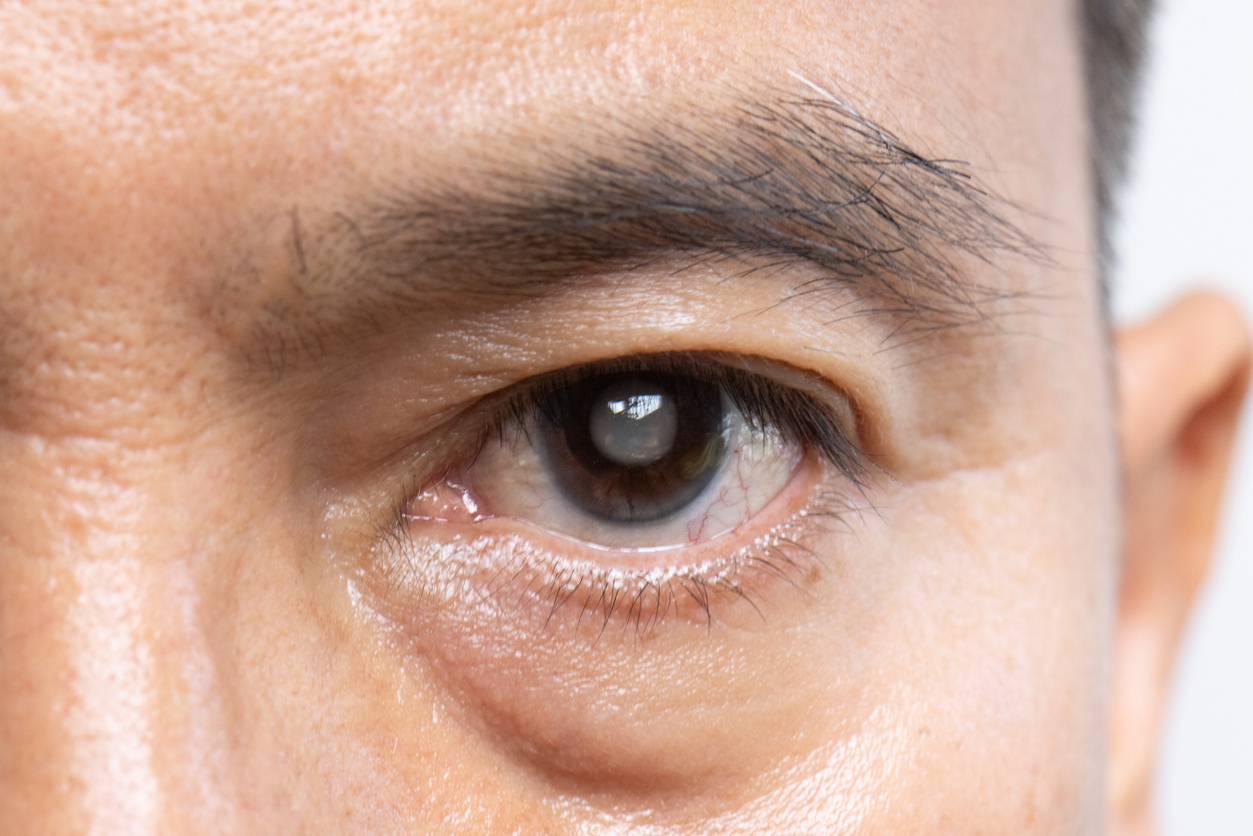 Istock 1868781504