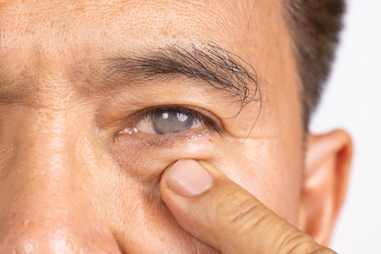 Istock 2219608897