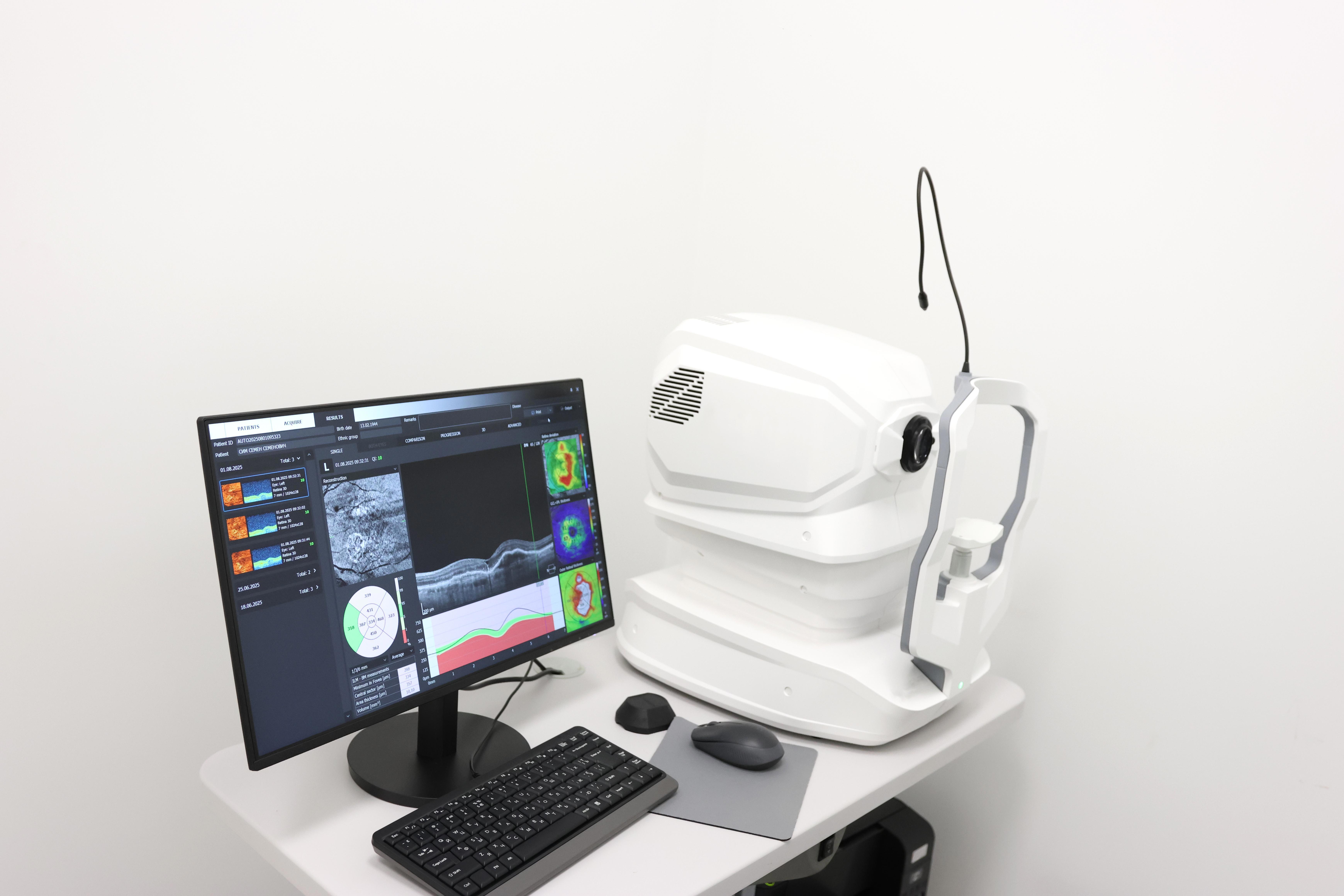 Optomap Scan Equipment