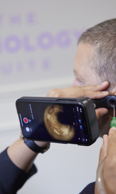 Bayfields painless ear wax removal service